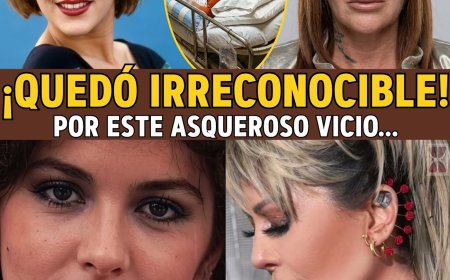 Alejandra Guzmán: De "Reina del Rock" a MUTILADA... El ASQUEROSO Vicio de Drogas y Bisturí. i