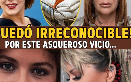 Alejandra Guzmán: De "Reina del Rock" a MUTILADA... El ASQUEROSO Vicio de Drogas y Bisturí. 