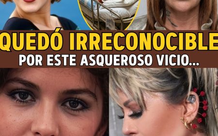 Alejandra Guzmán: De "Reina del Rock" a MUTILADA... El ASQUEROSO Vicio de Drogas y Bisturí