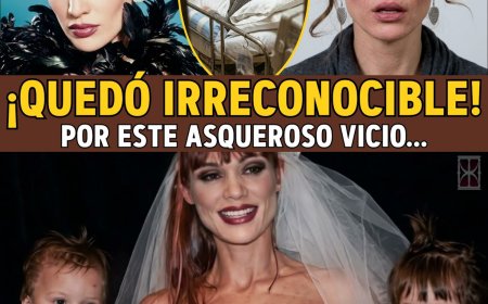Carmen Campuzano: De "Top Model" a DESFIGURADA... El ASQUEROSO Polvo que Pudrió su Nariz