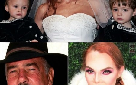 Carmen Campuzano: De "Top Model" a DESFIGURADA... El ASQUEROSO Polvo que Pudrió su Nariz. z