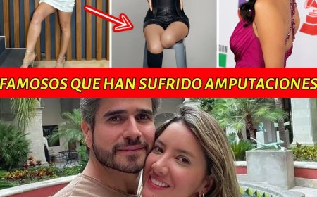 15 Famosos que han sufrido alguna amputación 