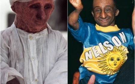 El día que MURIÓ Nelson de la Rosa - Biografía del famoso "HOMBRE RATA"