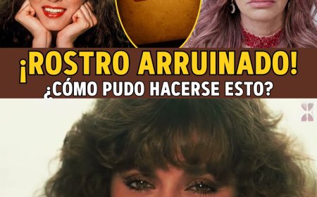 Lucía Méndez: De "El Rostro de México" a DESFIGURADA... El ASQUEROSO Vicio del Bisturí. 