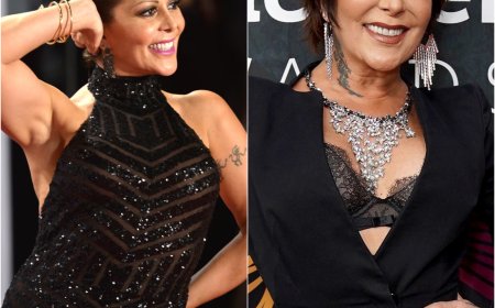 Alejandra Guzmán: De "Reina del Rock" a MUTILADA... El ASQUEROSO Vicio de Drogas y Bisturí.
