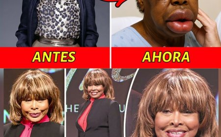 15 Leyendas negras del R&B que trágicamente lo perdieron todo por la cirugía plástica 